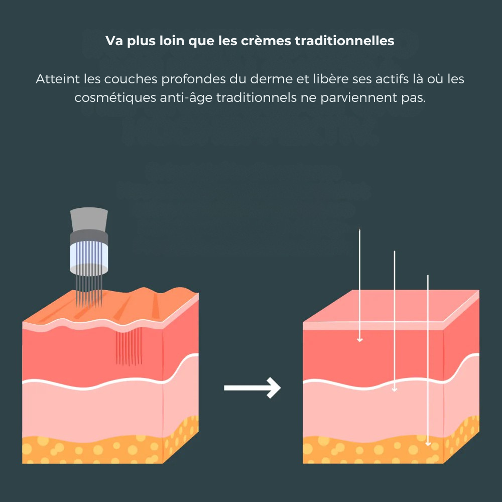 Eelhoe Micro-Infusion Lift Pro + Sérum extra offert
