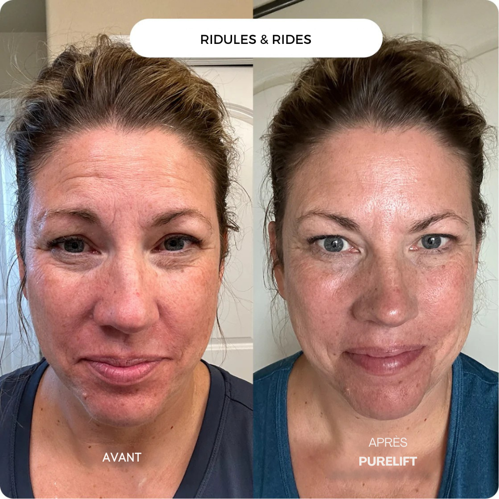 Eelhoe Micro-Infusion Lift Pro + Sérum extra offert