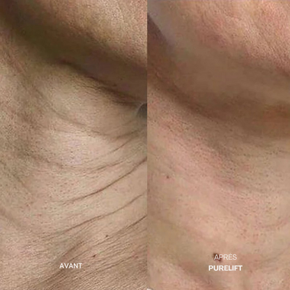Eelhoe Micro-Infusion Lift Pro + Sérum extra offert