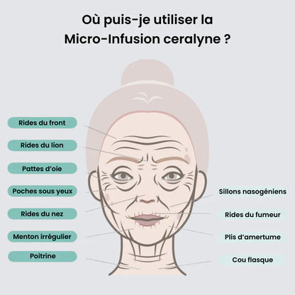 Eelhoe Micro-Infusion Lift Pro + Sérum extra offert